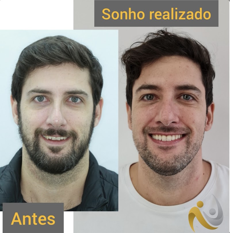 Dr. Raphael Tavares | Dentista | Invisalign Doctor - Savassi - foto 3