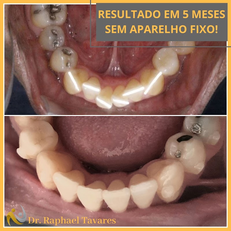 Dr. Raphael Tavares | Dentista | Invisalign Doctor - Savassi - foto 4