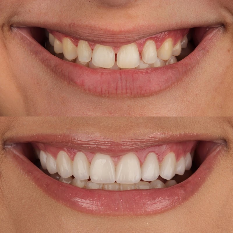 Dr. Pedro Cruz | Especialista em Odontologia Estética/ Dentista Teresópolis - foto 3