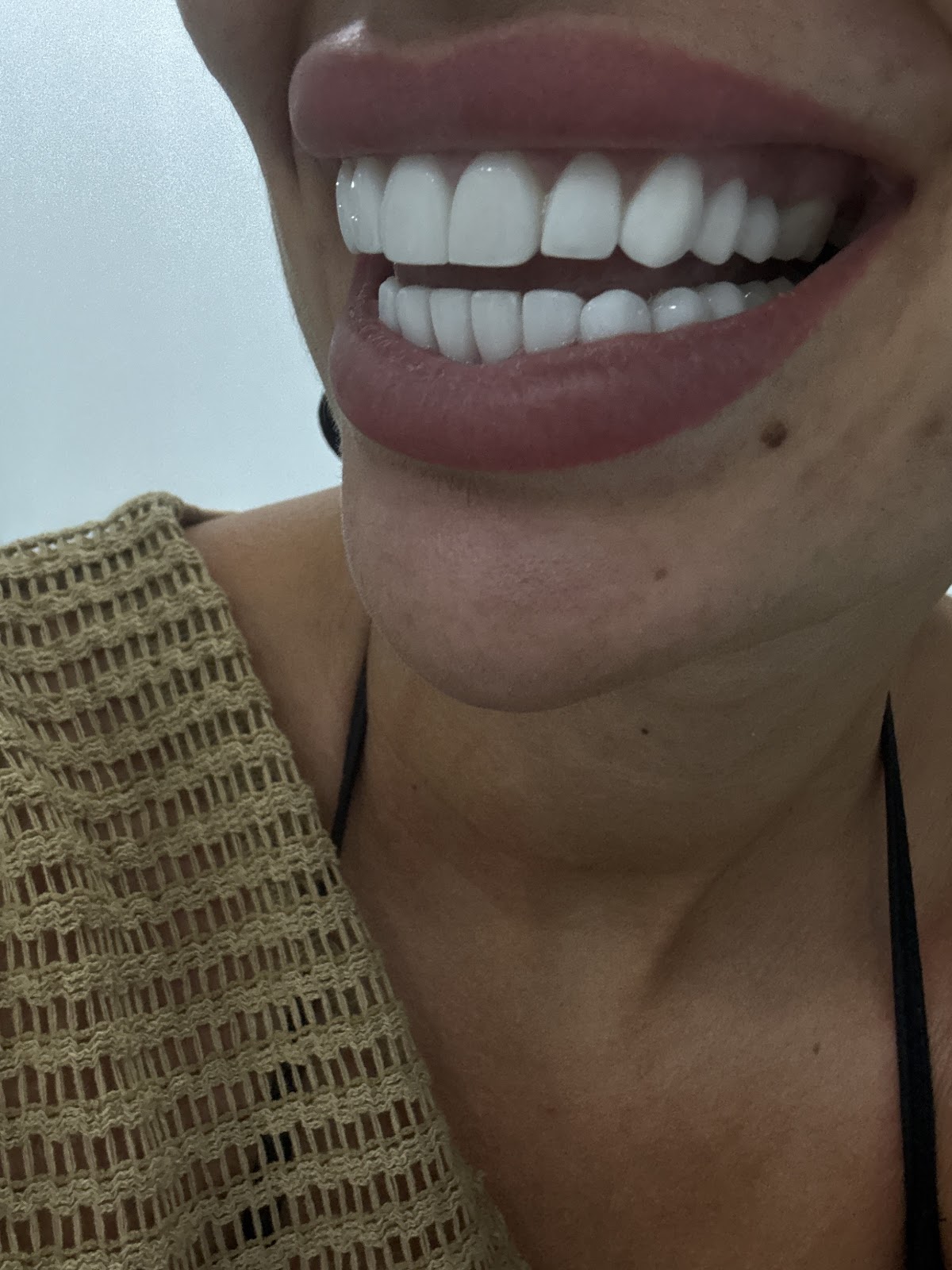 Pearly White Dental Clinic 3