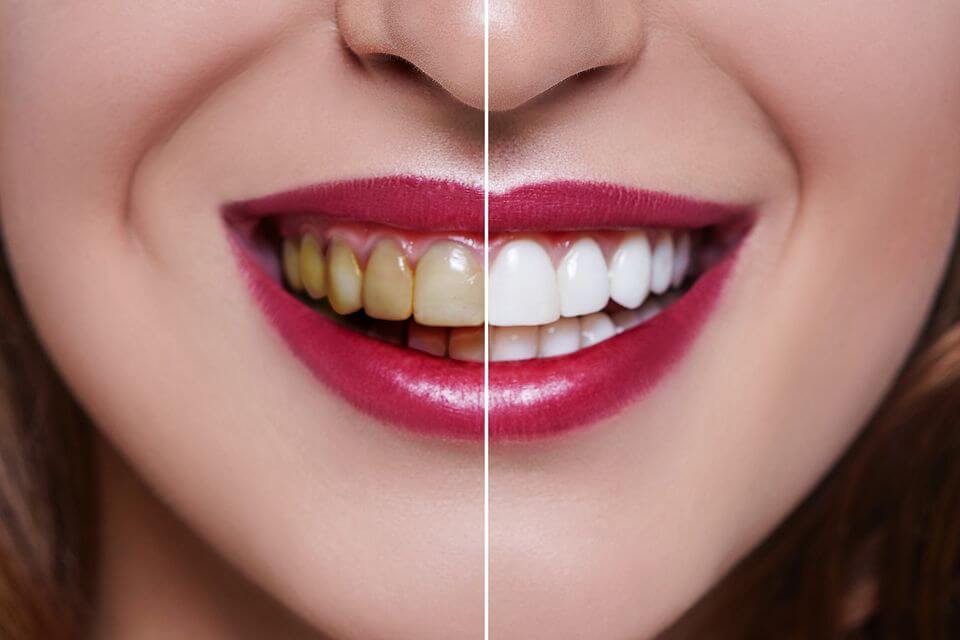 Pearly White Dental Clinic 4