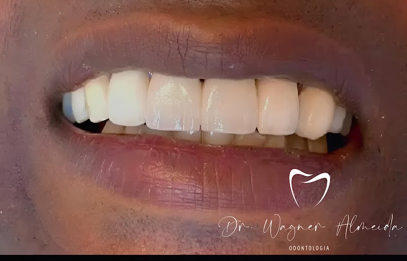 Dentista 24 Horas Macapá , Dr Wagner Almeida - foto 4
