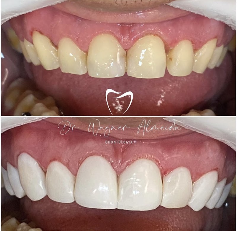 Dentista 24 Horas Macapá , Dr Wagner Almeida - foto 2