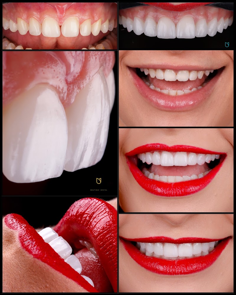 BertholdiBastos Boutique Dental | Dentista em Vitoria Especialista em Facetas e Implantes Dentários - foto 3