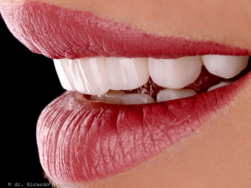 BertholdiBastos Boutique Dental | Dentista em Vitoria Especialista em Facetas e Implantes Dentários - foto 4