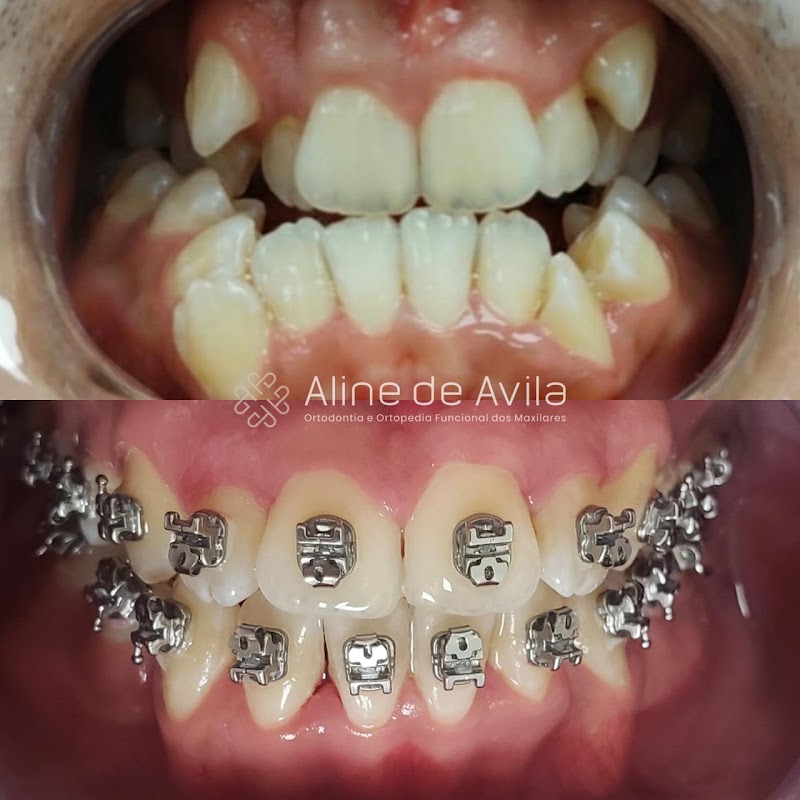 Dra Aline de Avila - Dentista em Curitiba | CRO-PR 26.534 - foto 2