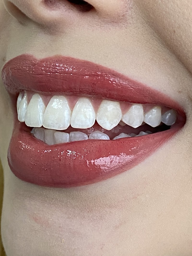 Dra. Morgane Marion ( Endodontia com Microscopia, Harmonização facial e Alinhadores Invisíveis) - foto 3