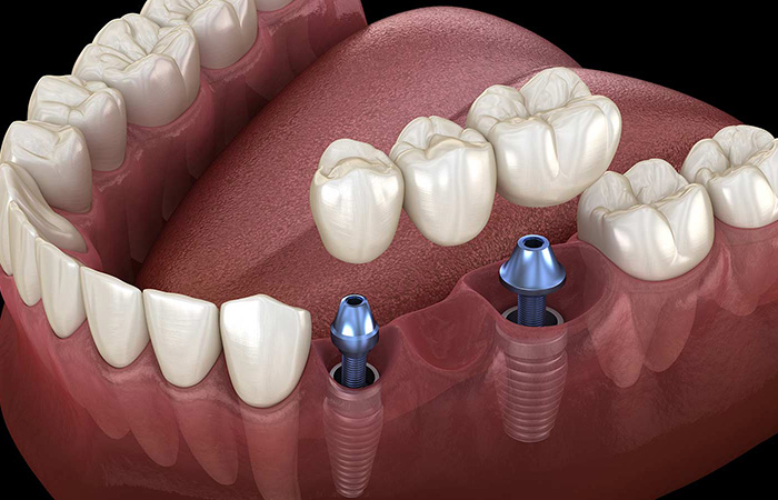 Green Tower Dental Clinic 5