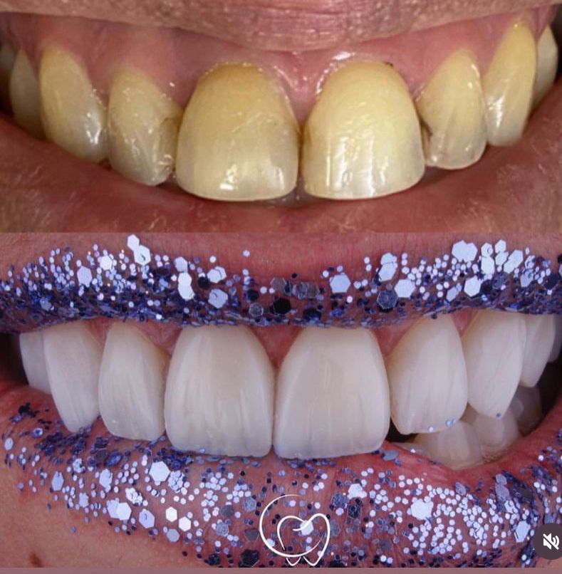 Clinica Odonto Vip Tirol- Dra Danielly Oliveira - foto 5