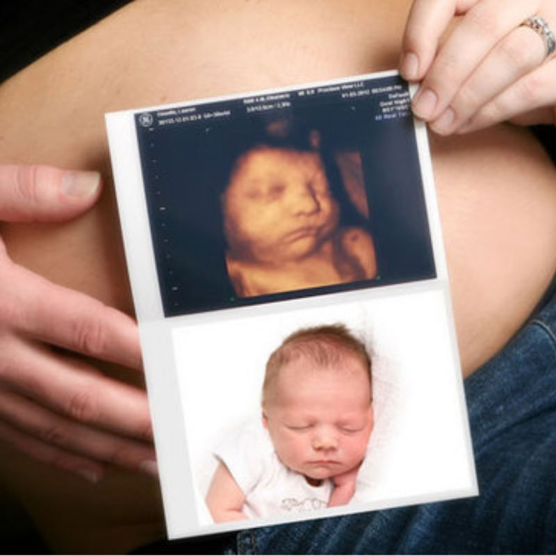 Phoenix 4D Ultrasound