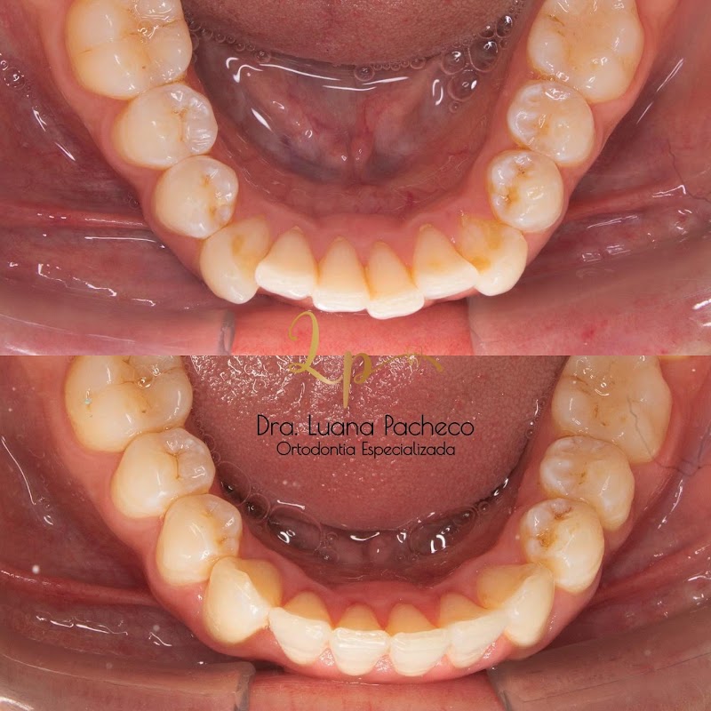 Dra. Luana Pacheco Ortodontia - foto 2