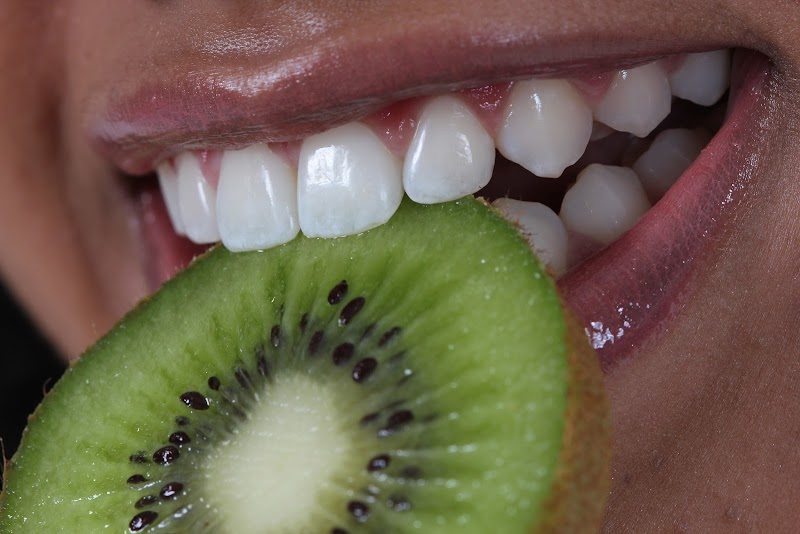 CLAREAMENTO DENTAL GOIANIA