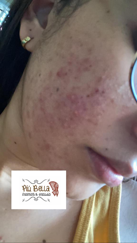 Rebeca Martínez. Estética Integral. - Imagen 3