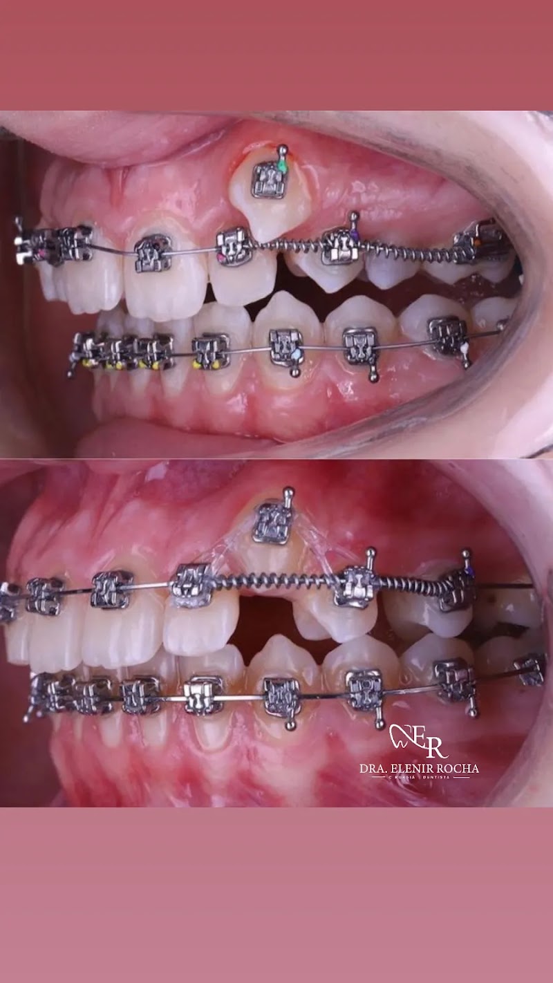 Dentista Dra. Elenir Rocha - foto 2