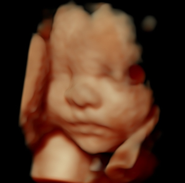 3D 4D HDLive Ultrasound - Cherished Memories