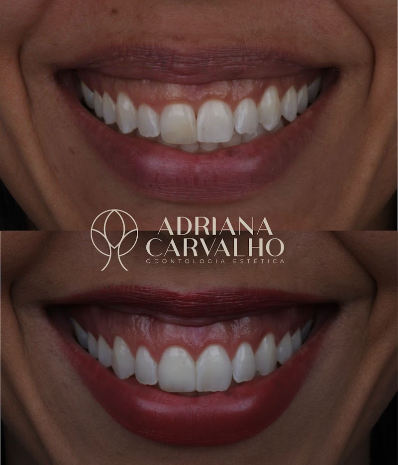 Dra. Adriana Oliveira Carvalho, Dentista Salvador - foto 5