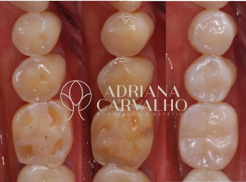 Dra. Adriana Oliveira Carvalho, Dentista Salvador - foto 1