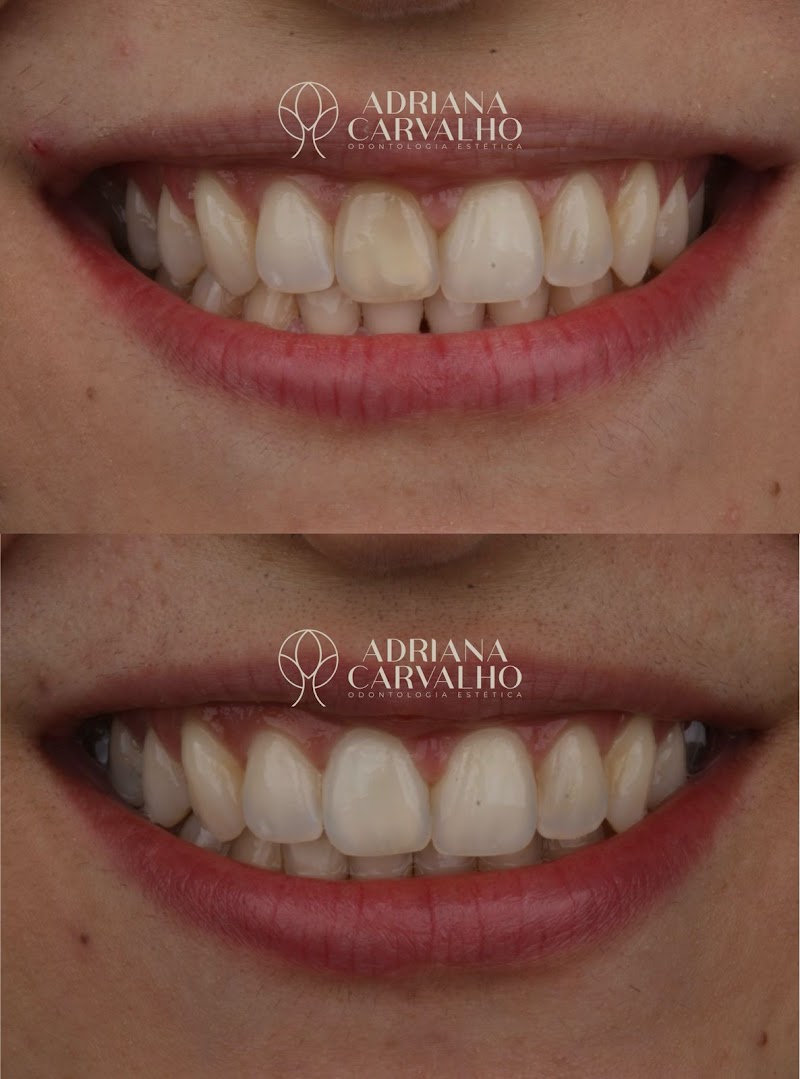 Dra. Adriana Oliveira Carvalho, Dentista Salvador - foto 3