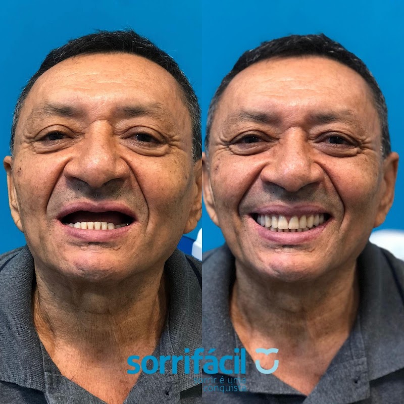 Sorrifácil - foto 1