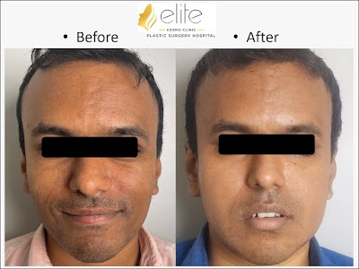 Dr.Ukarande's Elite Cosmo Clinic and plastic surgery hospital