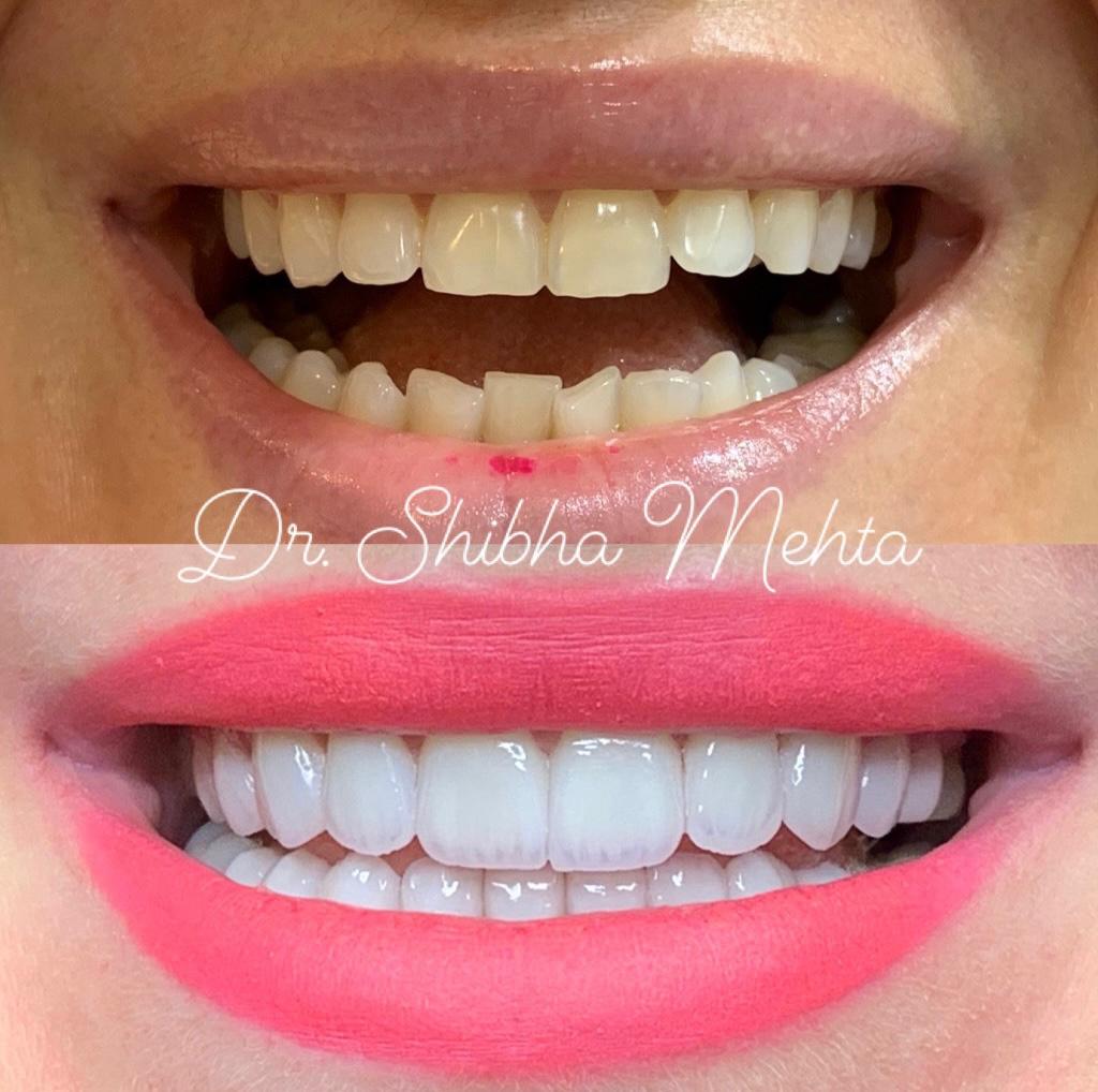 Dr Shibha Mehta Dubai Dental Clinic 5
