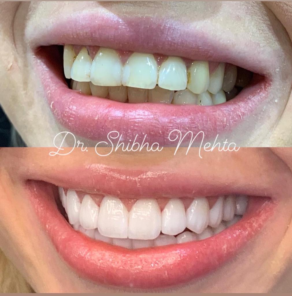 Dr Shibha Mehta Dubai Dental Clinic 4