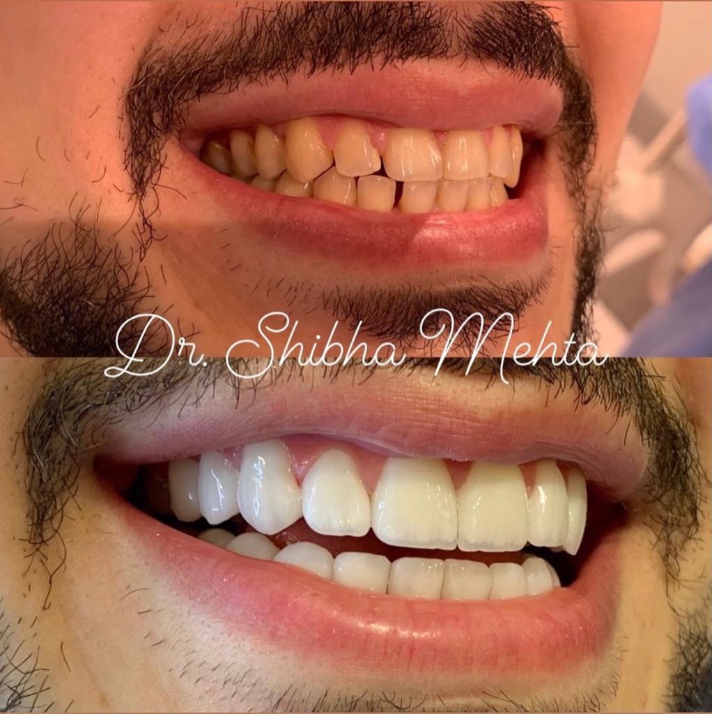 Dr Shibha Mehta Dubai Dental Clinic 3