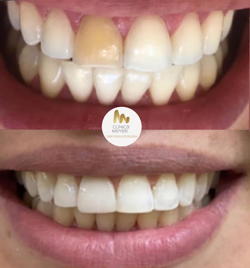 Clínica Meyer Odontologia Especializada/Estética em Resina/Salvador - foto 3