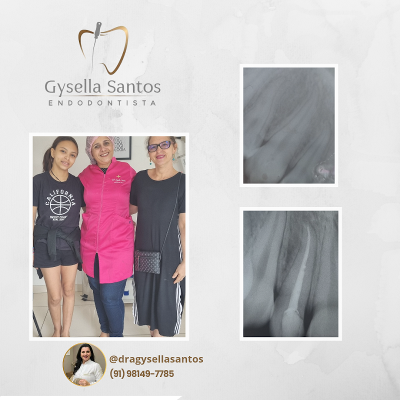 Dra. Gysella Santos | Endodontista - foto 2