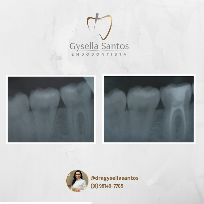 Dra. Gysella Santos | Endodontista - foto 3
