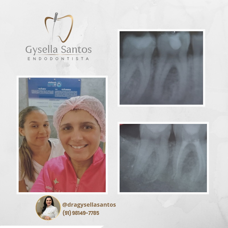 Dra. Gysella Santos | Endodontista - foto 5