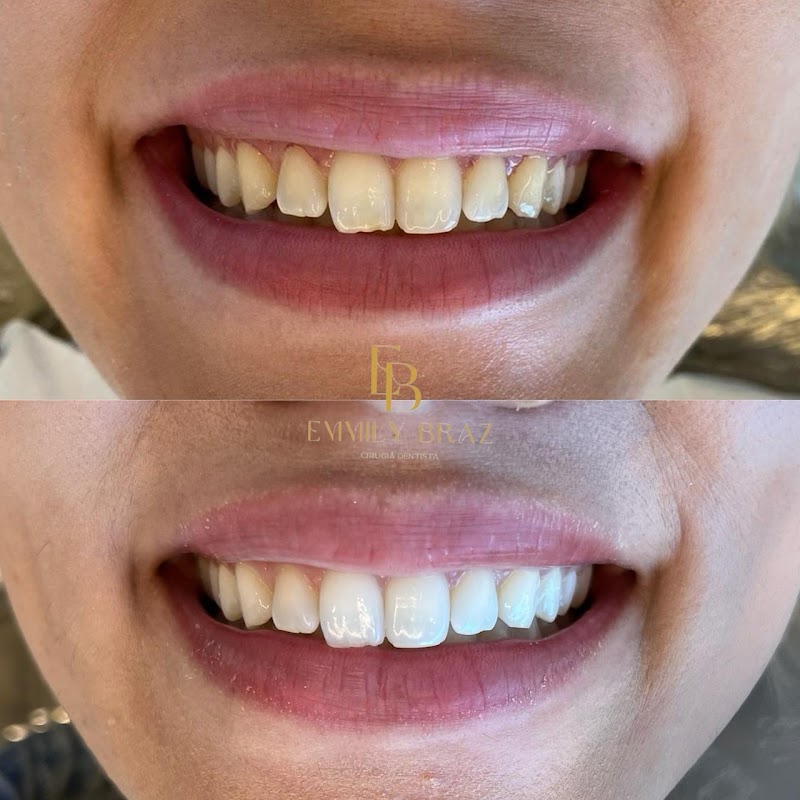 Dra Emmily Braz- Endodontista - foto 5