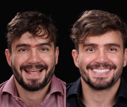 Estrelas Odontologia Dra. Flávia Lacerda. Cleo Octávio - foto 3