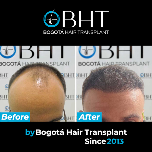 Trasplante capilar bht colombia logo