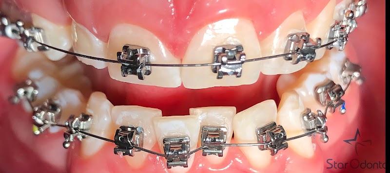 Dra Jaqueline Moreira | Ortodontia | clínica geral | implantes | prótese - foto 1