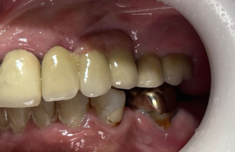 Dra Jaqueline Moreira | Ortodontia | clínica geral | implantes | prótese - foto 2