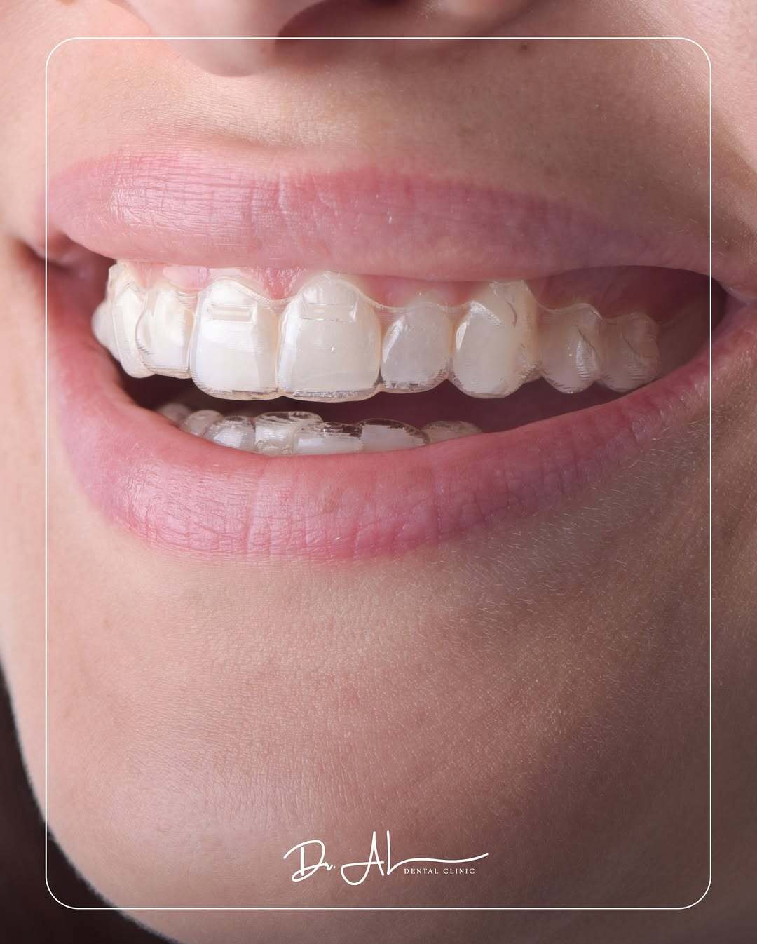 Dr. AL Dental Clinic - عيادة د. آل للأسنان 5