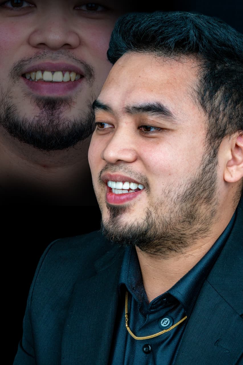Dr Zahid Hashim- Veneers Dental Clinic Al Rigga Deira 4