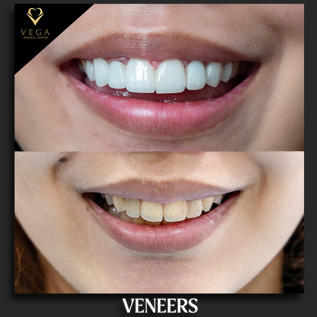 Dr Zahid Hashim- Veneers Dental Clinic Al Rigga Deira 2