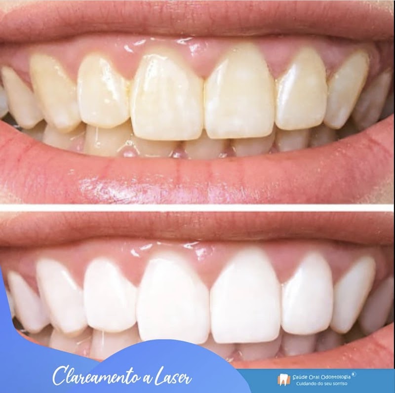 Saúde Oral Odontologia - foto 5