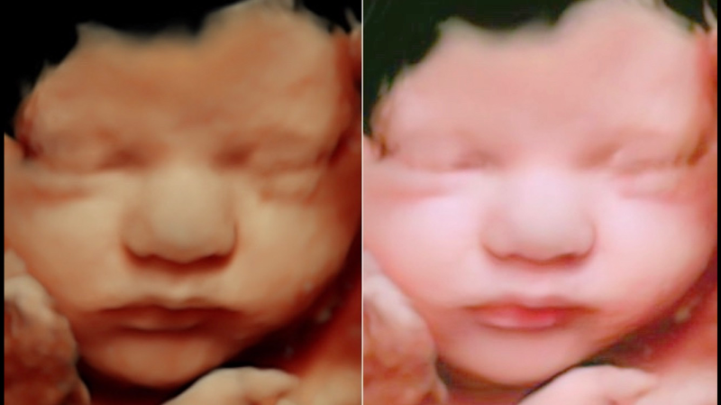 Your 4D Baby - 3D 4D & 5D Ultrasound