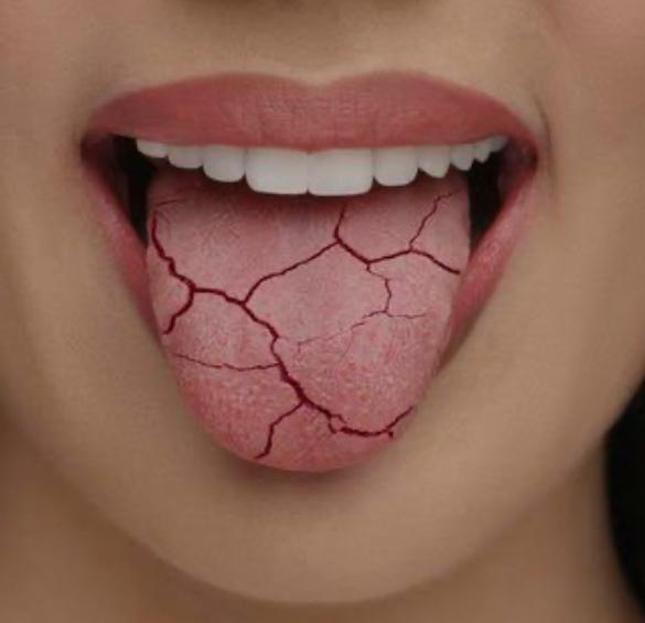 Dra Iluska Fontes - Implantes Dentários e Tratamento do Mau Halito - foto 3