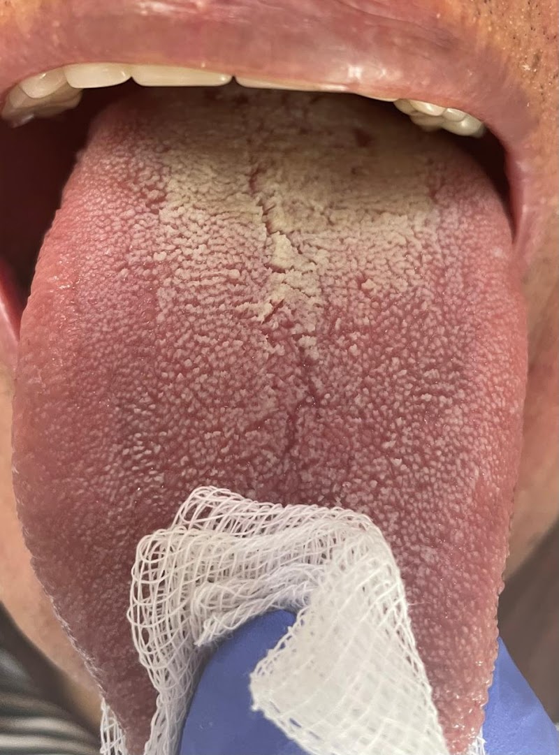 Dra Iluska Fontes - Implantes Dentários e Tratamento do Mau Halito - foto 4