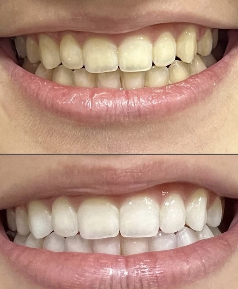 Dra Luhara Carvalho - Dentista em Cuiabá - foto 4