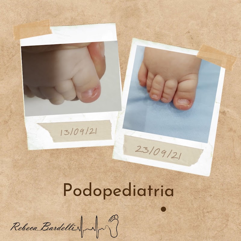 Foto de Rebeca Bardelli Podologia Clínica | Podologa | Unha encravada | Podologa Joinville | Tratamento de micose |