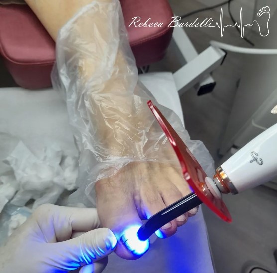 Foto de Rebeca Bardelli Podologia Clínica | Podologa | Unha encravada | Podologa Joinville | Tratamento de micose |