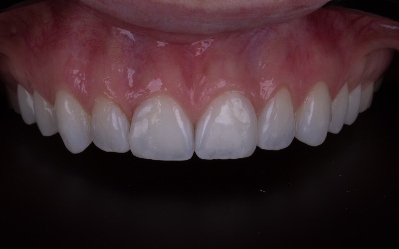 Centro de Clareamento Dental - Ribeirão Preto - foto 5