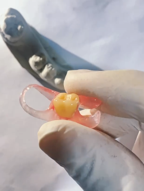 Dr. Misael Guimarães/ Implantes|DTM| Lente de contato| Canal - foto 2