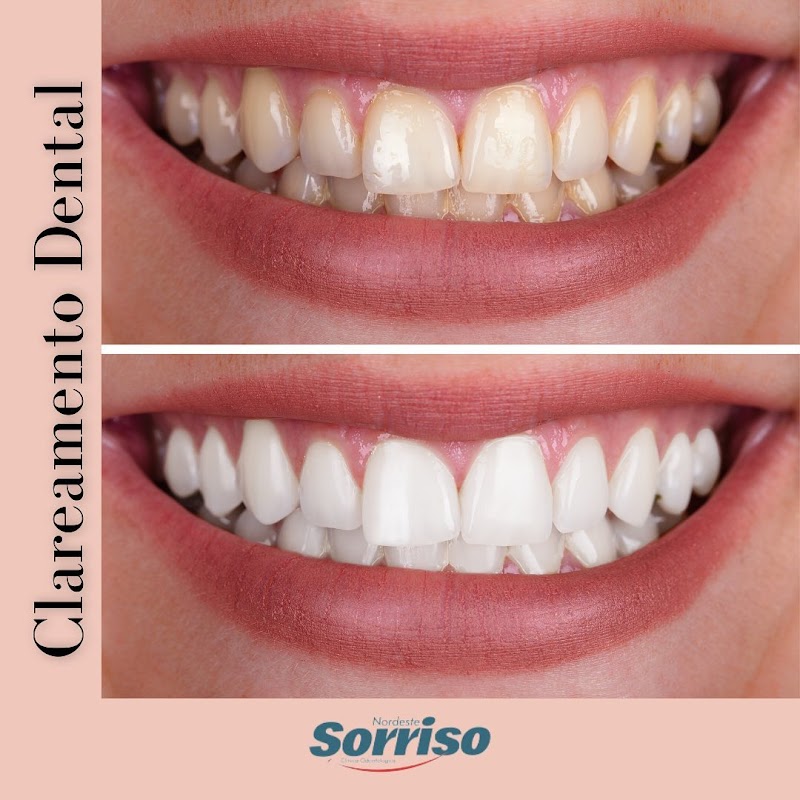 Nordeste Sorriso - foto 4