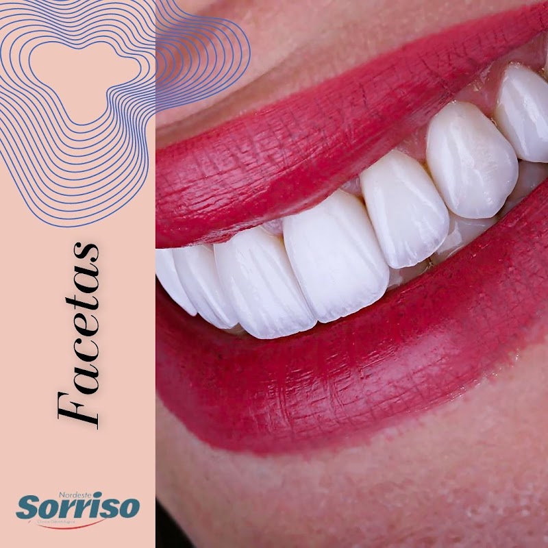 Nordeste Sorriso - foto 3
